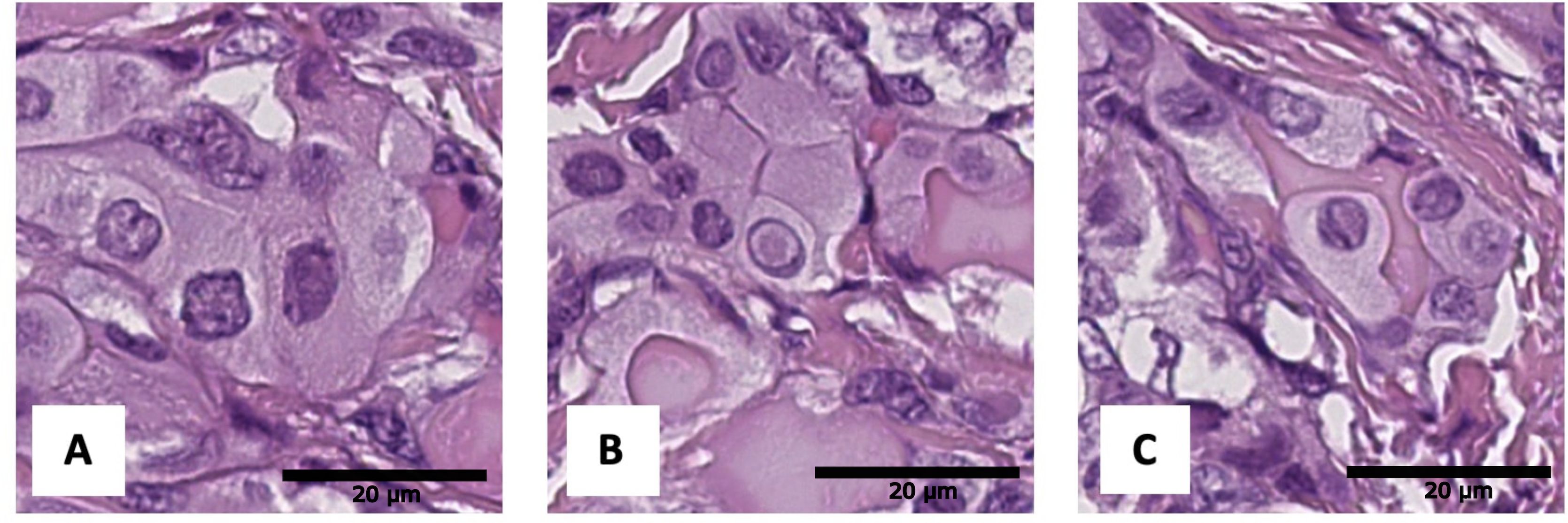 Microscopic images labeled A, B, and C display tissue samples stained with hematoxylin and eosin. The purple and pink hues highlight cellular structures and extracellular components, with a 20 micrometer scale bar in each image.