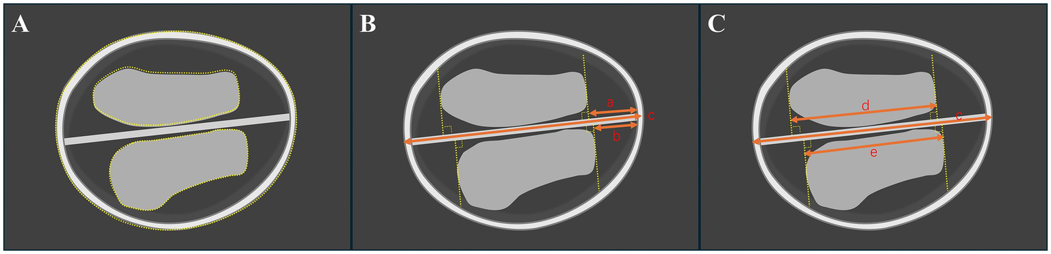 Diagram showing three panels labeled A, B, and C. Panel A depicts two oval shapes with dotted outlines and a diagonal white line. Panel B shows the same shapes with three orange measurement lines labeled "a," "b," and "c," intersecting the shapes vertically. Panel C features the same configuration with two new horizontal orange lines labeled "d" and "e," also intersecting the shapes. All panels are set against a dark background.
