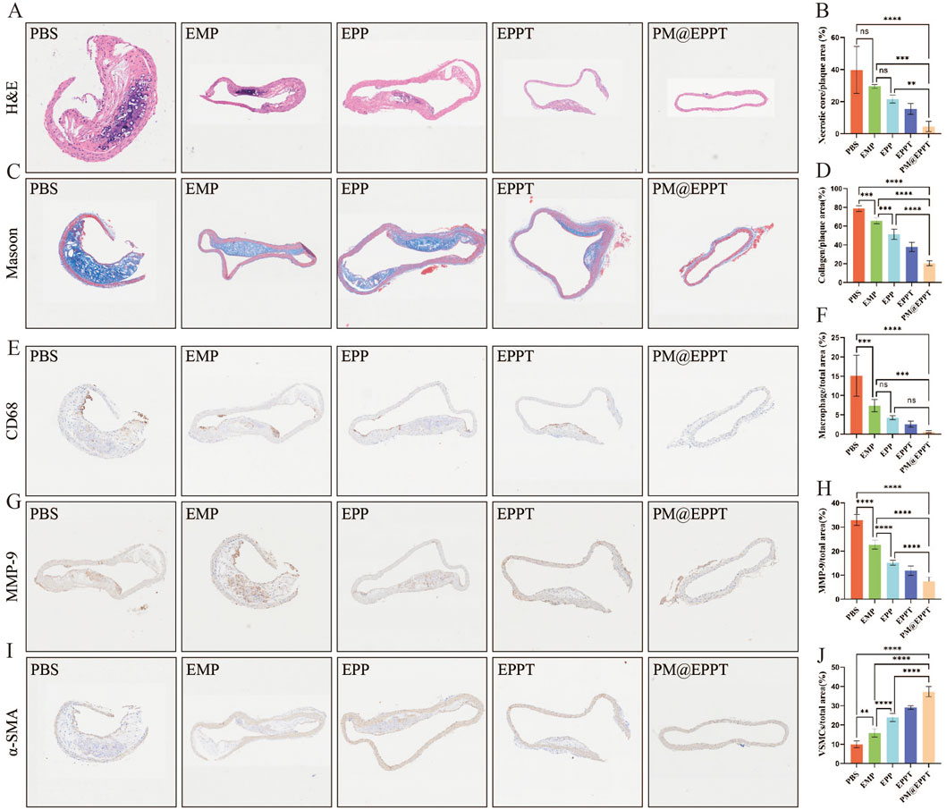 Histological examination of tissue samples using different staining techniques, including H&E and Masson stain. Images depict varying conditions: PBS, EMP, EPP, EPPT, and PM@EPPT. Adjacent bar graphs (B, D, F, H, J) display quantification of parameters such as necrotic core/plaque area, collagen/plaque area, macrophage/plaque area, MMP-9/plaque area, and VSMC/collagen area, with statistical significance marked by asterisks.