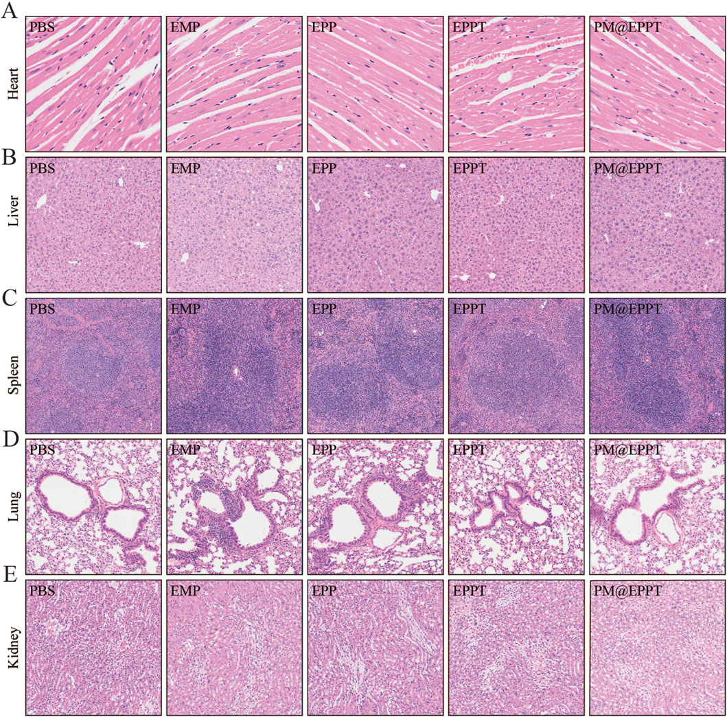 Histological sections of various organs (heart, liver, spleen, lung, kidney) in a grid pattern. Each row represents an organ with five conditions: PBS, EMP, EPP, EPPT, and PM@EPPT. The images display tissue structure variations under these conditions.