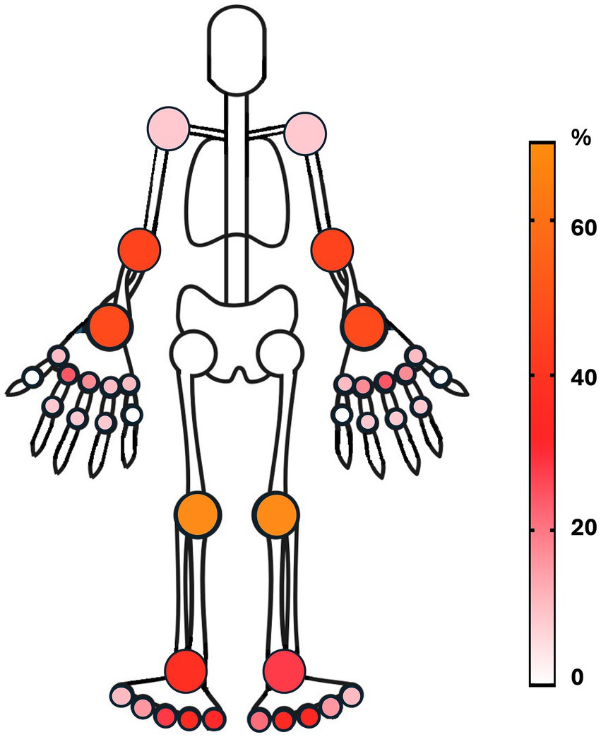 Diagram of a human skeleton with colored joints and digits representing data percentages. Red and orange indicate high values, with saturation decreasing towards pink and white. A vertical gradient bar on the right shows the percentage scale from zero to sixty.