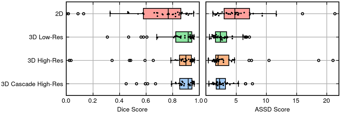 Box and swarm plots of the DICE and ASSD scores for the different models.