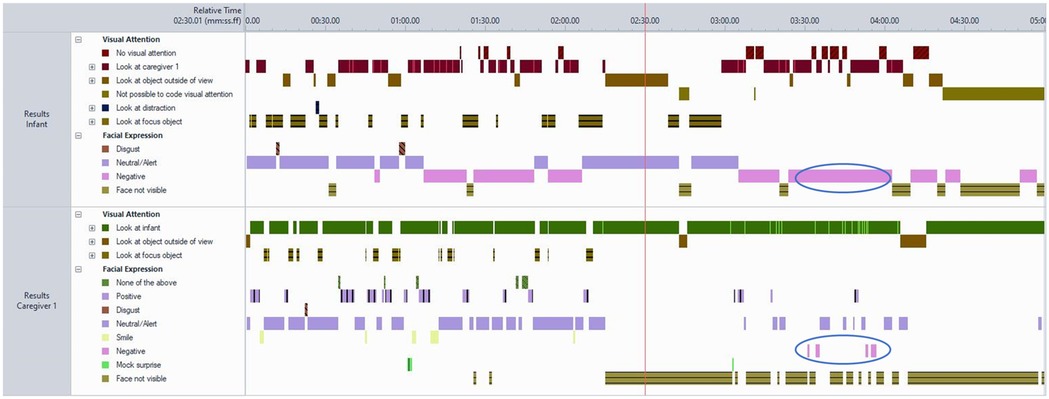 Timeline visualisation of a five-minute parent–infant interaction as coded in Observer XT. Parallel horizontal bars display time-stamped behavioural streams for the infant (upper panel) and caregiver (lower panel), each showing sequences of visual attention and facial expression categories coded continuously and independently. Behaviours such as Look at caregiver, Look at focus object, Neutral/Alert, and Negative are represented by distinct colours. Two circled sections mark periods of co-occurring negative facial expressions between infant and caregiver. The figure illustrates how synchronised, sequential behavioural data were used to quantify patterns of attention and affect during the recorded interaction.