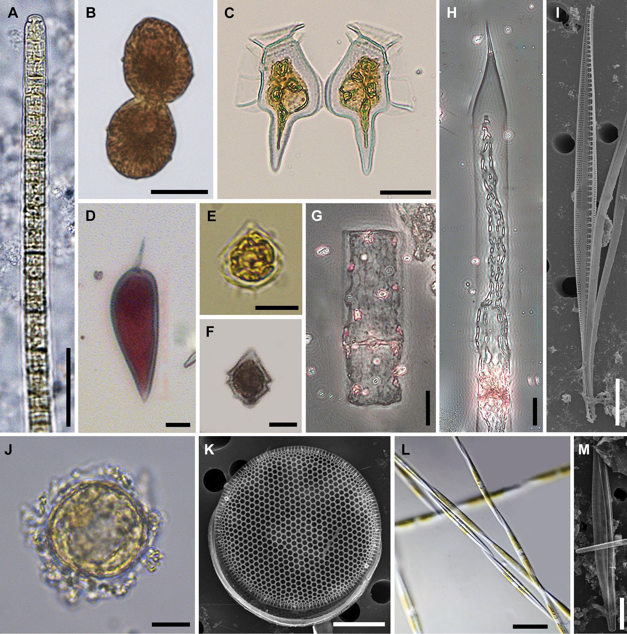 A collage of microscopic images shows different phytoplankton species observed under various magnifications. Each frame displays distinct shapes and structures, highlighting the diverse physical characteristics of the organisms, such as filaments, spheres, and complex geometric forms. The scale bars in each image imply variation in size among the different species.