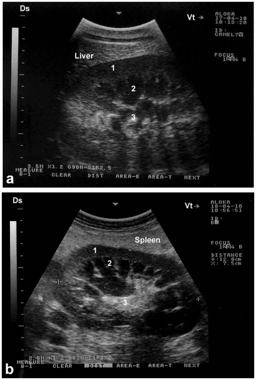 Ultrasound images of the abdomen, labeled a and b. Image a shows the liver marked with numbers 1, 2, and 3, indicating areas of interest. Image b displays the spleen with similar markings and corresponding numbers.