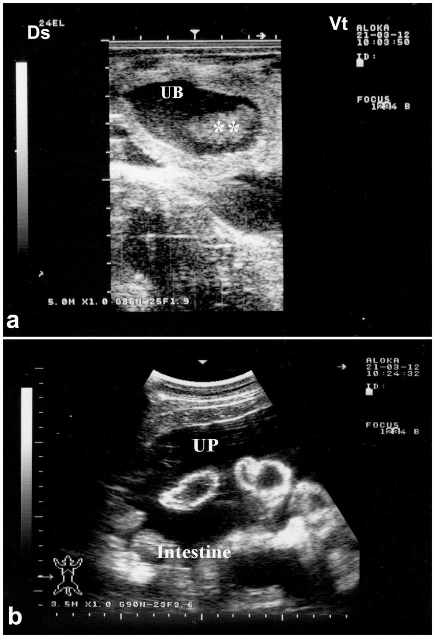 Ultrasound images with annotations. Panel (a) shows the urinary bladder (UB) with two asterisks nearby. Panel (b) shows structures labeled as