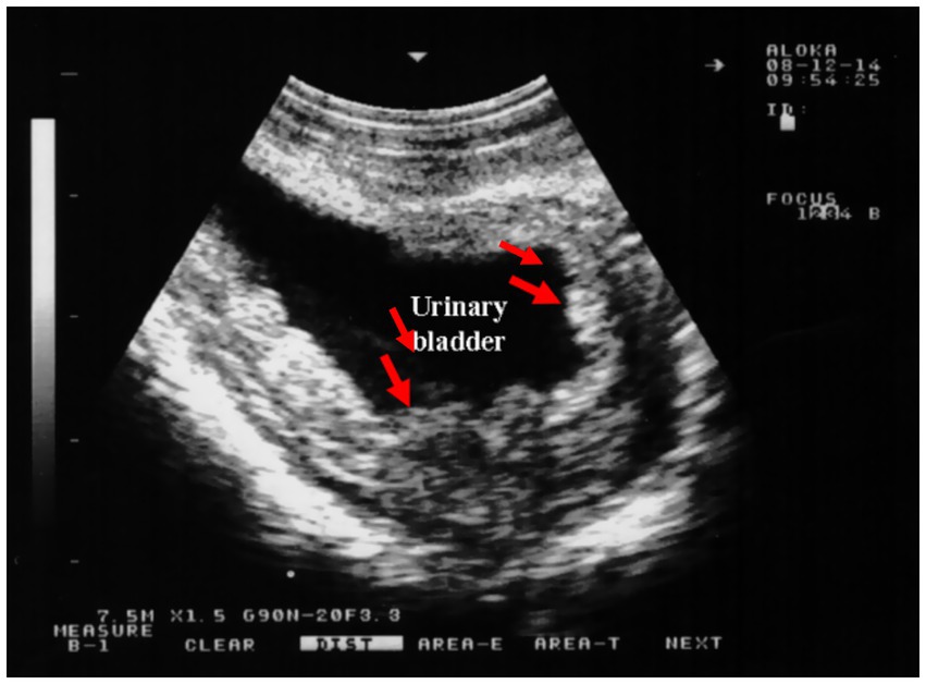 Ultrasound image showing a cross-section of the urinary bladder, highlighted with red arrows. The screen displays various measurement details and settings on the top and bottom edges.