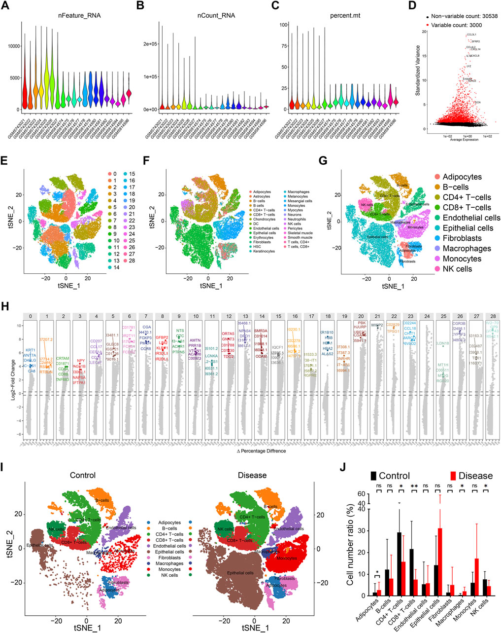 Multiple panels depict data from a scientific study. Panels A-C show violin plots of RNA features, counts, and percentages across samples. Panel D displays a scatter plot of gene variability. Panels E-G illustrate t-SNE visualizations of cell clusters, each labeled by type, such as T-cells and macrophages. Panel H contains box plots of gene expression changes. Panel I compares t-SNE plots of control and disease samples. Panel J presents a bar graph comparing cell number ratios between control and disease groups, highlighting differences in cell types.