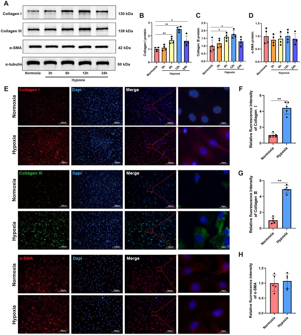 Western blot and graphs showing protein expression levels for collagen I, collagen III, α-SMA, and α-tubulin under normoxia and hypoxia over time (A-D). Immunofluorescence images display collagen I, collagen III, and α-SMA expression under normoxia and hypoxia. Graphs indicate relative fluorescent intensities for each protein (E-H), showing increased expression under hypoxia. Data is statistically analyzed with significance indicated.