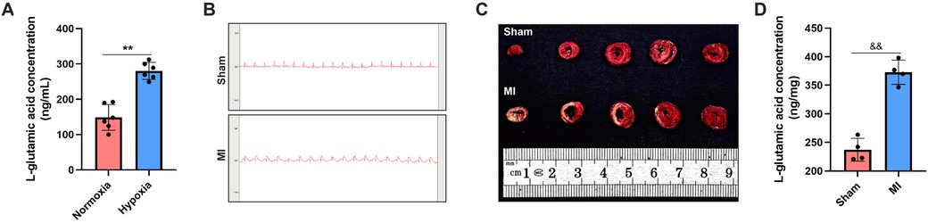 Panel A shows a bar graph comparing L-glutamic acid concentration under normoxia and hypoxia, with higher levels in hypoxia. Panel B presents ECG traces for Sham and MI, showing increased heart activity in MI. Panel C contains cross-sections of heart tissue from Sham and MI groups, with MI showing more damage. Panel D is a bar graph indicating higher L-glutamic acid concentration in MI compared to Sham.