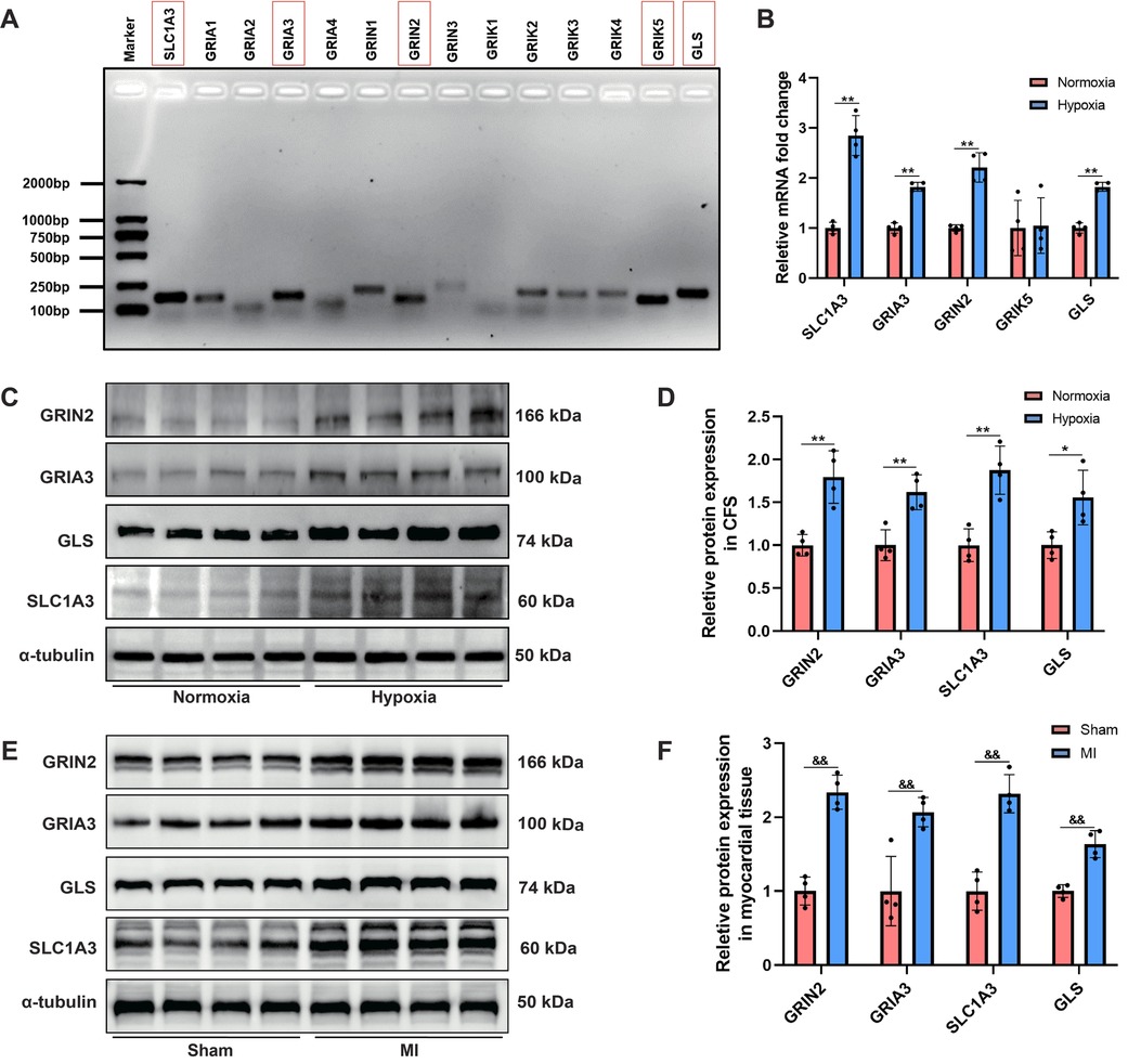 Panel A shows a gel electrophoresis image displaying bands for different genes. Panel B presents a bar graph comparing relative mRNA fold changes under normoxia and hypoxia. Panels C and E display western blots for various proteins under normoxia, hypoxia, sham, and myocardial infarction conditions. Panels D and F depict bar graphs of relative protein expression in C6 cells and myocardial tissue under similar conditions. Different bands and bars indicate variations in expression levels and experimental conditions, with annotations for statistical significance.