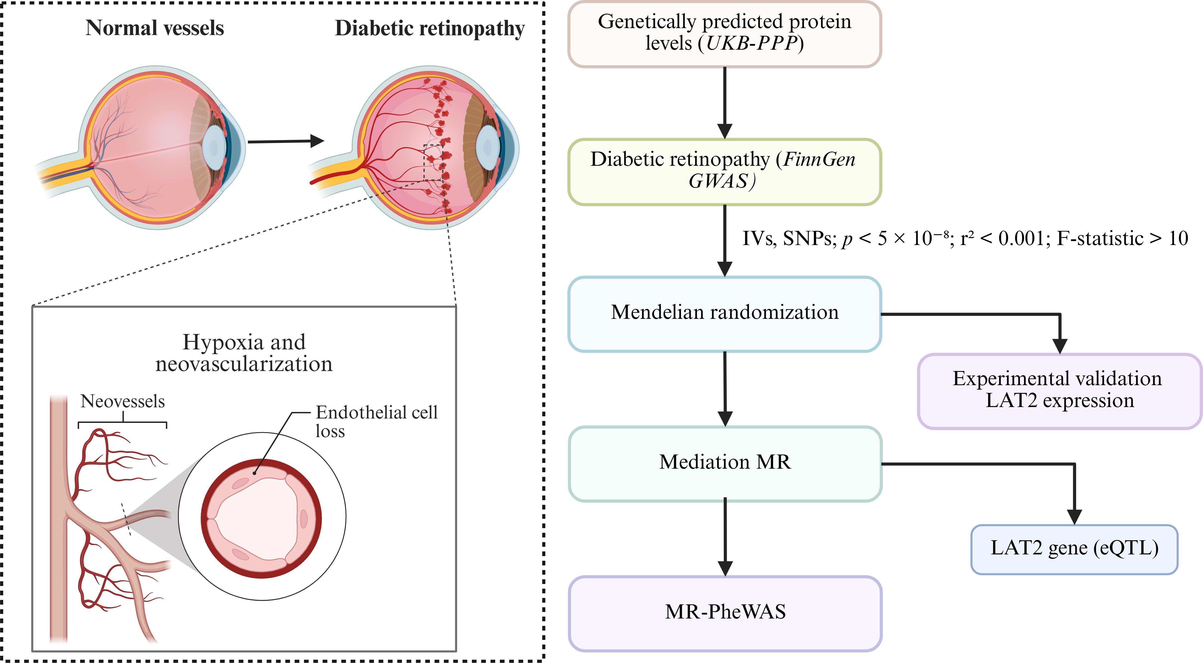 Diagram illustrating diabetic retinopathy. On the left, a comparison shows normal eye vessels versus diabetic retinopathy with neovascularization and endothelial cell loss. On the right, a flowchart details genetically predicted protein levels influencing diabetic retinopathy (FinnGen GWAS) through Mendelian randomization, mediation MR, and MR-PheWAS, leading to LAT2 gene expression validation.
