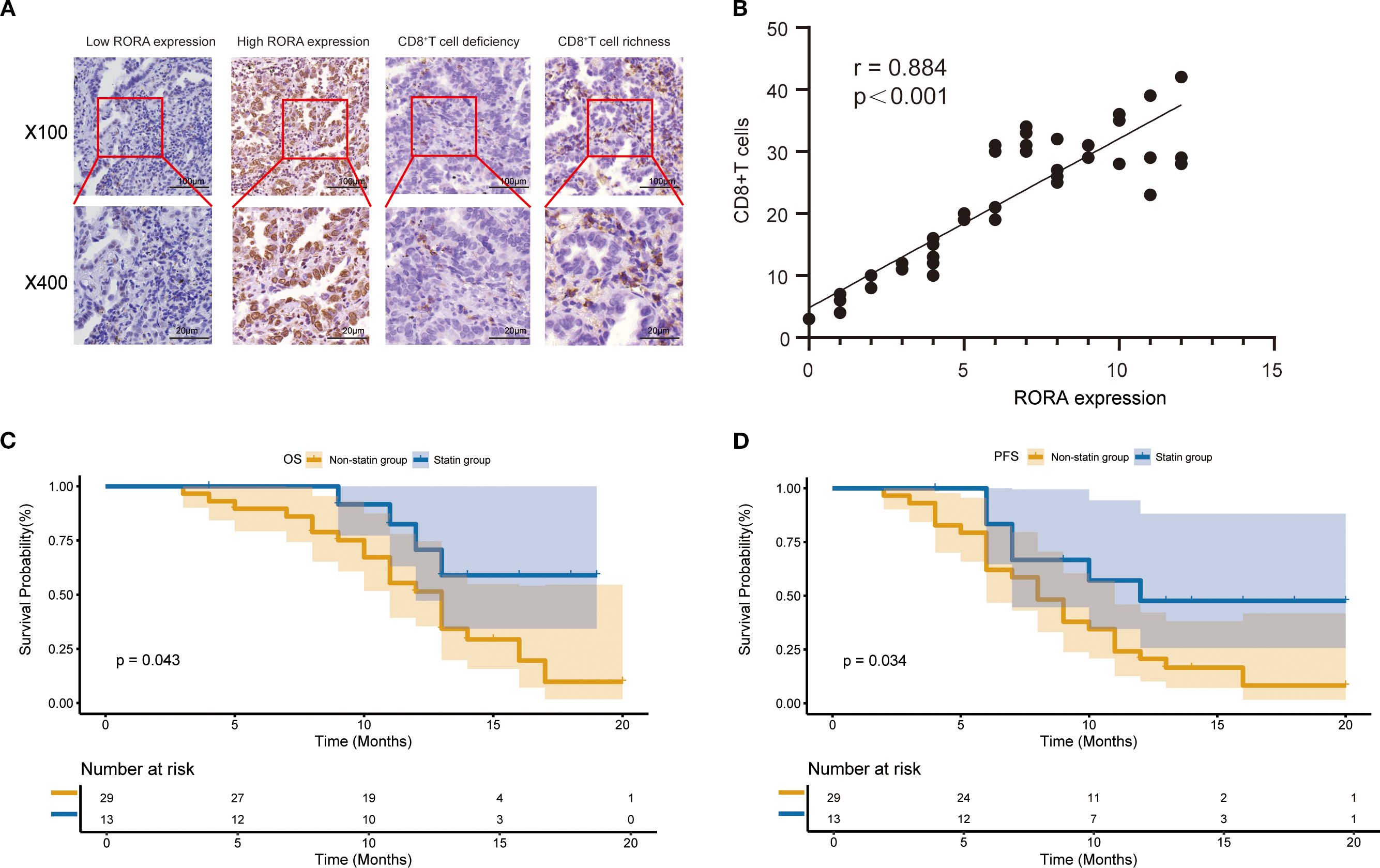 Panel A shows immunohistochemical staining with varying RORA expression and CD8+ T cell presence at magnifications of X100 and X400. Panel B displays a scatter plot with a positive correlation (r = 0.884, p < 0.001) between RORA expression and CD8+ T cell count. Panels C and D present Kaplan-Meier survival curves comparing statin and non-statin groups, showing statistical significance in survival probability (p = 0.043 for OS, p = 0.034 for PFS) over time with detailed numbers at risk.