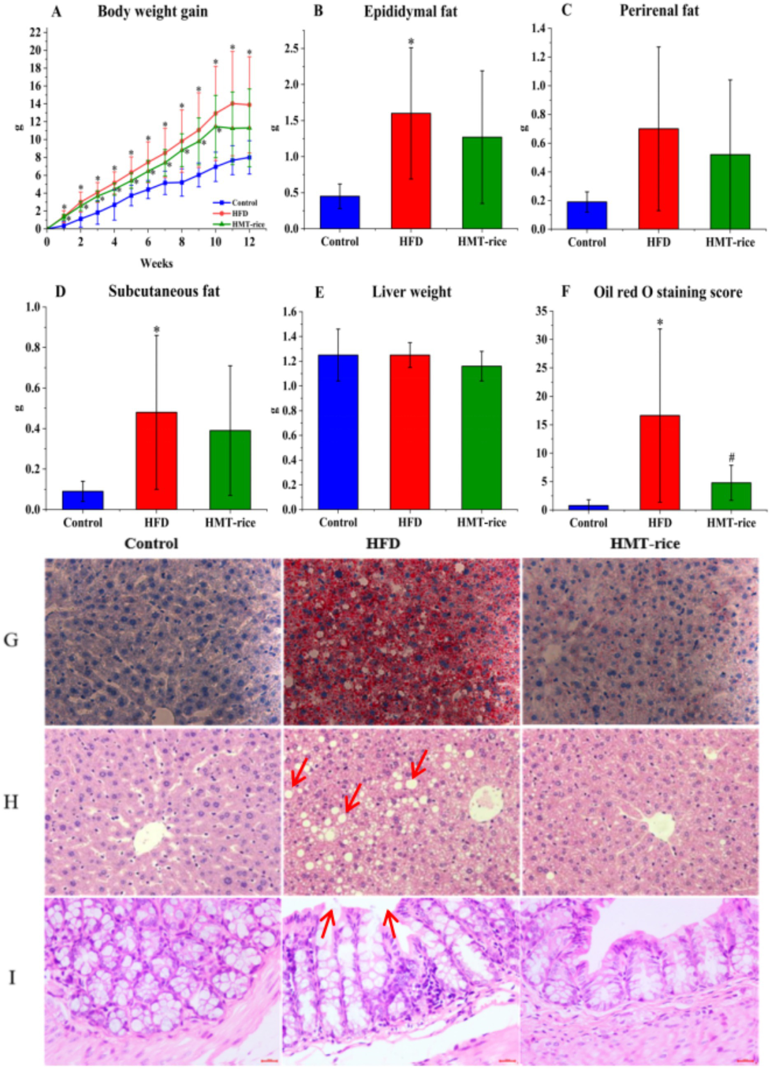 Graphs and images present study results comparing control, high-fat diet (HFD), and HMT-rice groups. Graphs A to F show different measures: body weight gain, epididymal fat, perirenal fat, subcutaneous fat, liver weight, and Oil Red O staining scores, with HFD generally higher. Images G to I display histological comparisons of liver and colon tissues, highlighting cellular changes, with arrows indicating specific features in the HFD group.