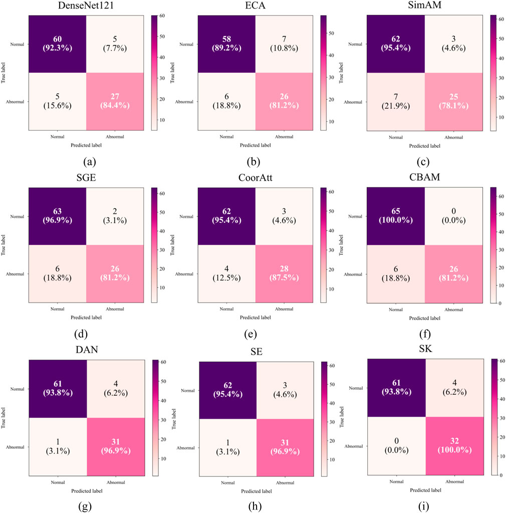 Nine confusion matrices labeled (a) to (i) compare different models' predictions with actual data. Each matrix shows true labels on the vertical axis and predicted labels on the horizontal axis, divided into normal and abnormal categories. Percentages and counts indicate accuracy for each classification. Models include DenseNet121, ECA, SimAM, SGE, CoorAtt, CBAM, DAN, SE, and SK. CBAM and SK show highest accuracy for normal and abnormal predictions, respectively. Colors range from dark purple to light pink, representing varying data density.