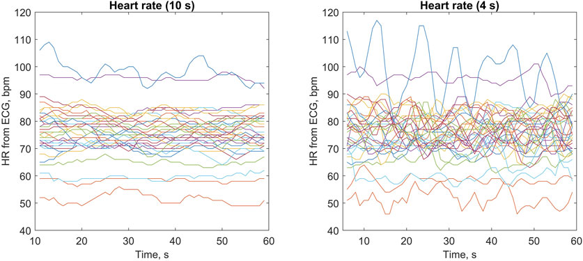 Two line graphs compare heart rates over sixty seconds using electrocardiogram data. The left graph shows heart rate averaged over ten-second intervals, while the right displays heart rate averaged over four-second intervals. Both graphs feature multiple colored lines representing different subjects, with heart rate ranging from forty six to one hundred seventeen beats per minute.