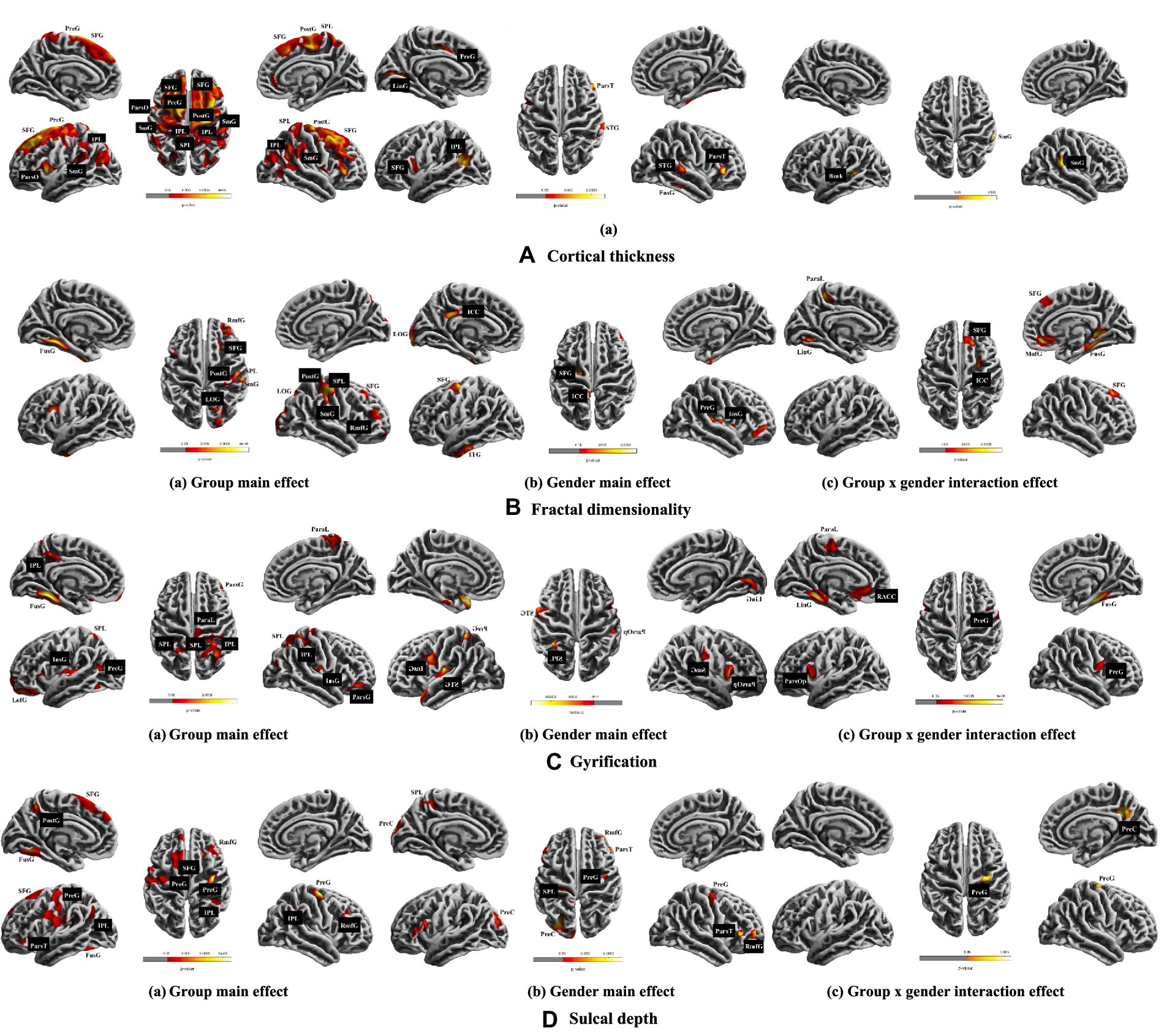 Brain scan images depict analyses of cortical thickness, fractal dimensionality, gyrification, and sulcal depth. They are arranged in four segments labeled A to D. Each segment is divided into three columns: group main effect, gender main effect, and group by gender interaction effect. Colored markers highlight different brain regions for each effect in the models.