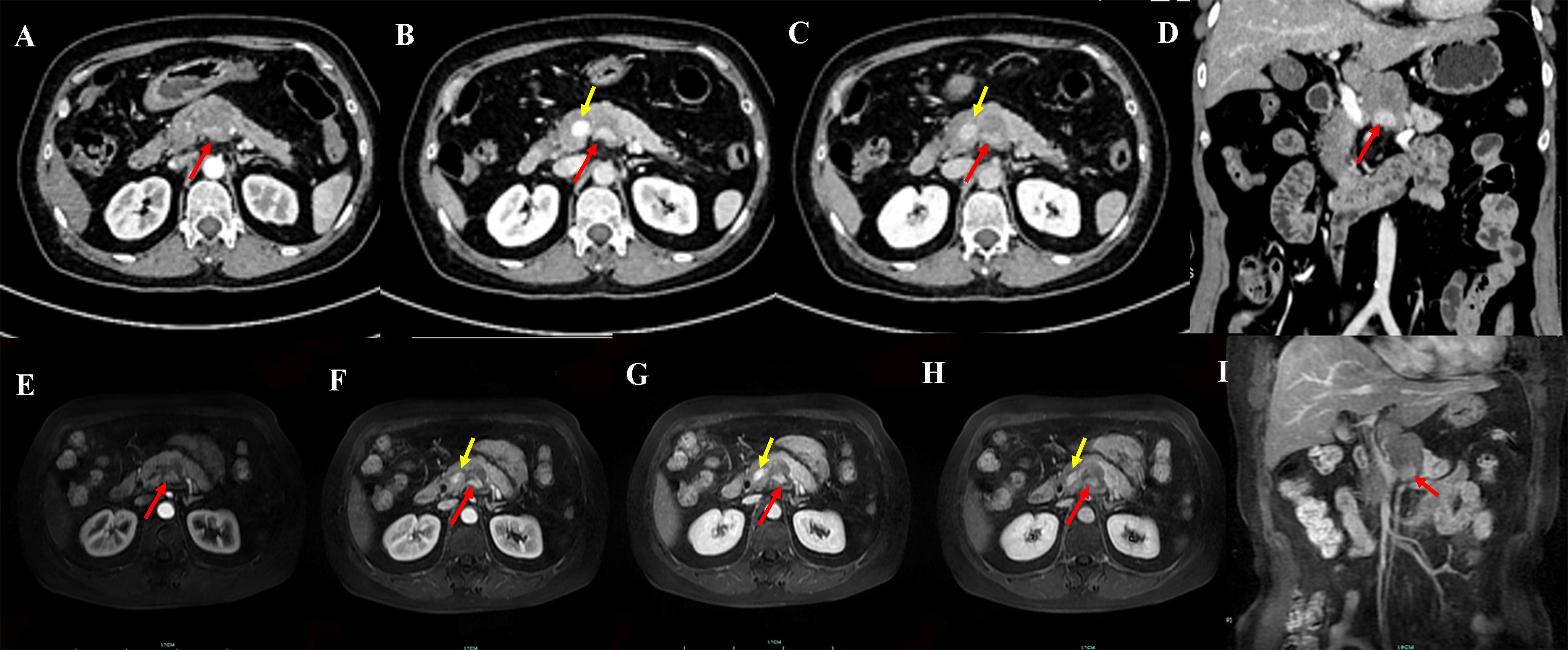 CT and MRI scans showing abdominal cross-sections labeled A through I. Panels A, D, and E show red arrows pointing to certain structures, while panels B, C, F, G, and H include both red and yellow arrows indicating other areas. The images highlight various anatomical sections with contrasting details in grayscale.
