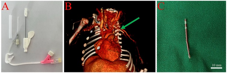 Panel A shows a medical device kit with a needle and catheter. Panel B is a 3D medical imaging scan of the chest, highlighting a blood vessel with an arrow. Panel C displays a removed, elongated surgical wire on a green background, with a 10 millimeter scale for reference.