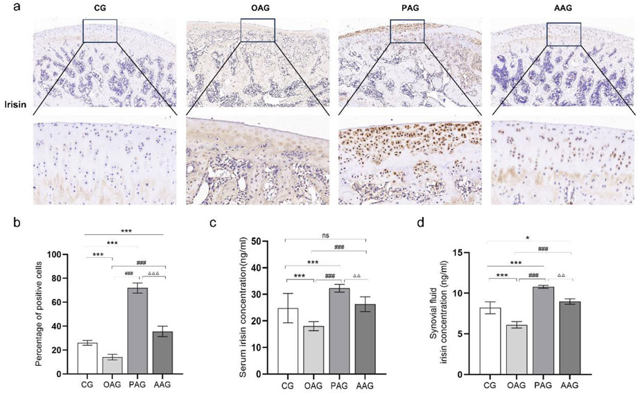 Histological images and bar charts illustrate irisin expression in four groups: control group (CG), OA model group (OAG), passive activity group (PAG), and active activity group (AAG). The images display tissue staining with varied irisin levels. Bar charts show the percentage of positive cells, serum irisin concentration, and synovial fluid irisin concentration across groups, with PAG showing significantly higher levels compared to others. Statistical significance is indicated with asterisks and symbols.