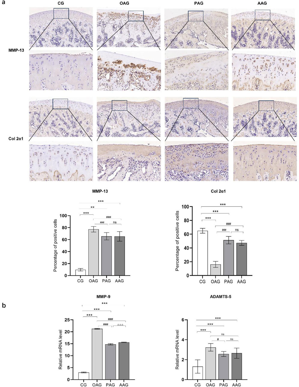 Scientific comparison of protein expression in different groups. Part (a) shows immunohistochemistry images for MMP-13 and Col 2a1 proteins in CG, OAG, PAG, and AAG groups, with close-up views. Bar graphs display the percentage of positive cells for each protein. Part (b) features bar charts showing relative mRNA levels of MMP-9 and ADAMTS-5 across the same groups. Statistical significance is noted with symbols.