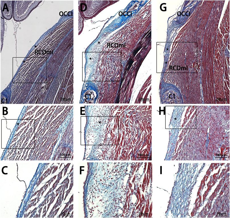 Histological images labeled A to I show microscopic views of tissues stained in blue and red hues. Panels A, D, and G highlight broader tissue structures, with rectangular insets focusing on specific areas. Panels B, E, and H zoom further into these areas, showing finer details of the tissue composition. Panels C, F, and I provide the most magnified views, emphasizing individual tissue fibers and cellular structures. The labels