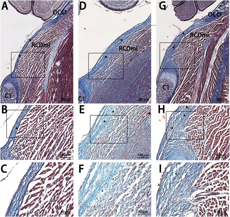 Histology images show stained muscle tissue sections labeled with letters A through I. Images A, D, and G display larger tissue sections, while B, E, H show medium magnifications, and C, F, I depict close-up views. Labels such as