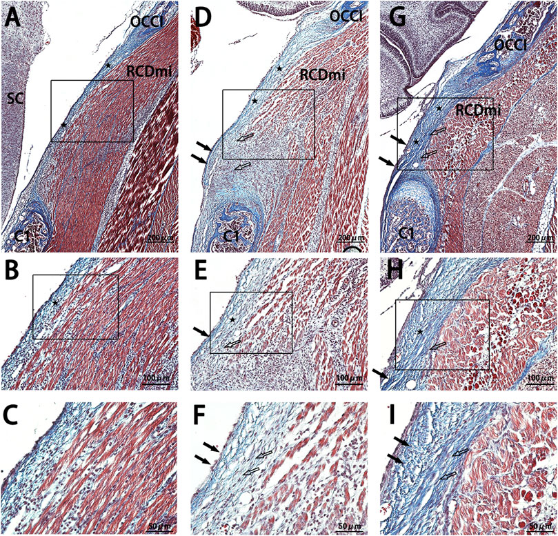 Histological images showing sections of tissue stained to highlight various structures. Panels A, D, and G depict lower magnification views with labeled areas, while B, E, and H show medium magnification close-ups of those regions. Panels C, F, and I provide higher magnification details, focusing on specific tissue features. Arrows and labels indicate areas of interest, such as muscle fibers and connective tissues, with scale bars for reference. The images illustrate the structural differences and cellular arrangements within the samples.