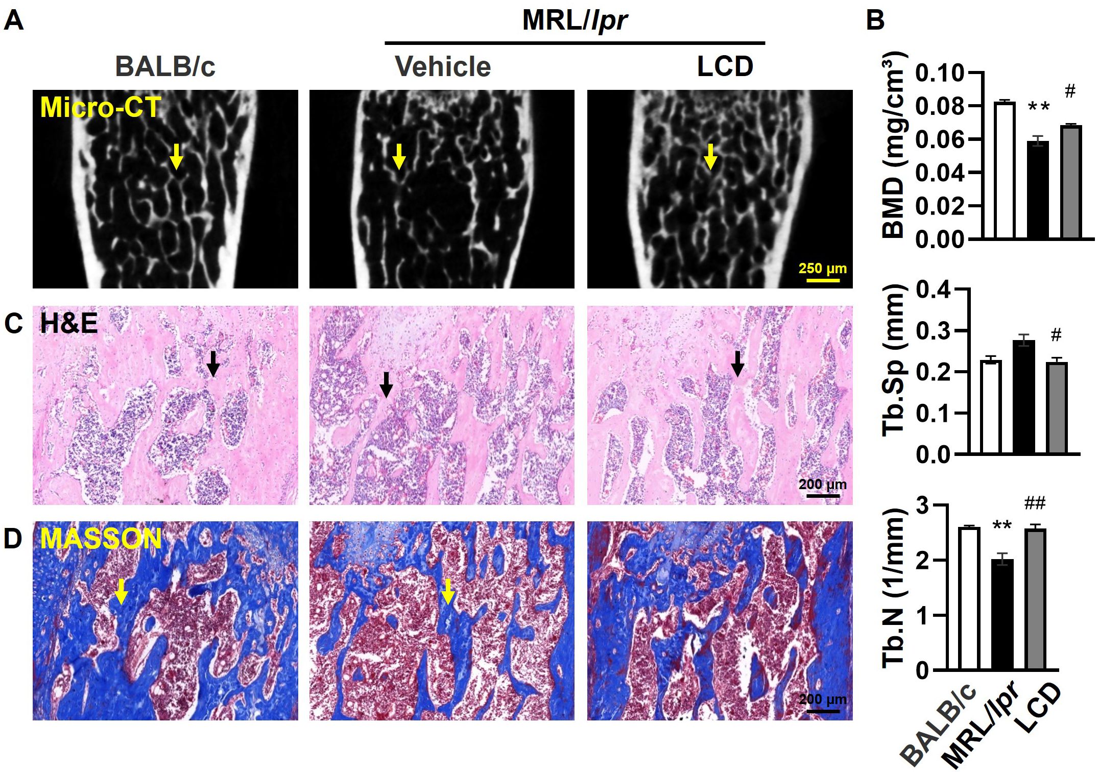 Panel A shows micro-CT images of bone sections from BALB/c and MRL/lpr mice treated with vehicle and LCD, with arrows indicating bone structure. Panel B presents bar graphs comparing bone mineral density (BMD), trabecular separation (Tb.Sp), and trabecular number (Tb.N) between different groups. Panel C displays H&E stained bone sections, highlighting cellular differences among the groups. Panel D shows Masson’s trichrome stained bone sections, demonstrating differences in collagen deposition. Yellow and black arrows indicate areas of interest.