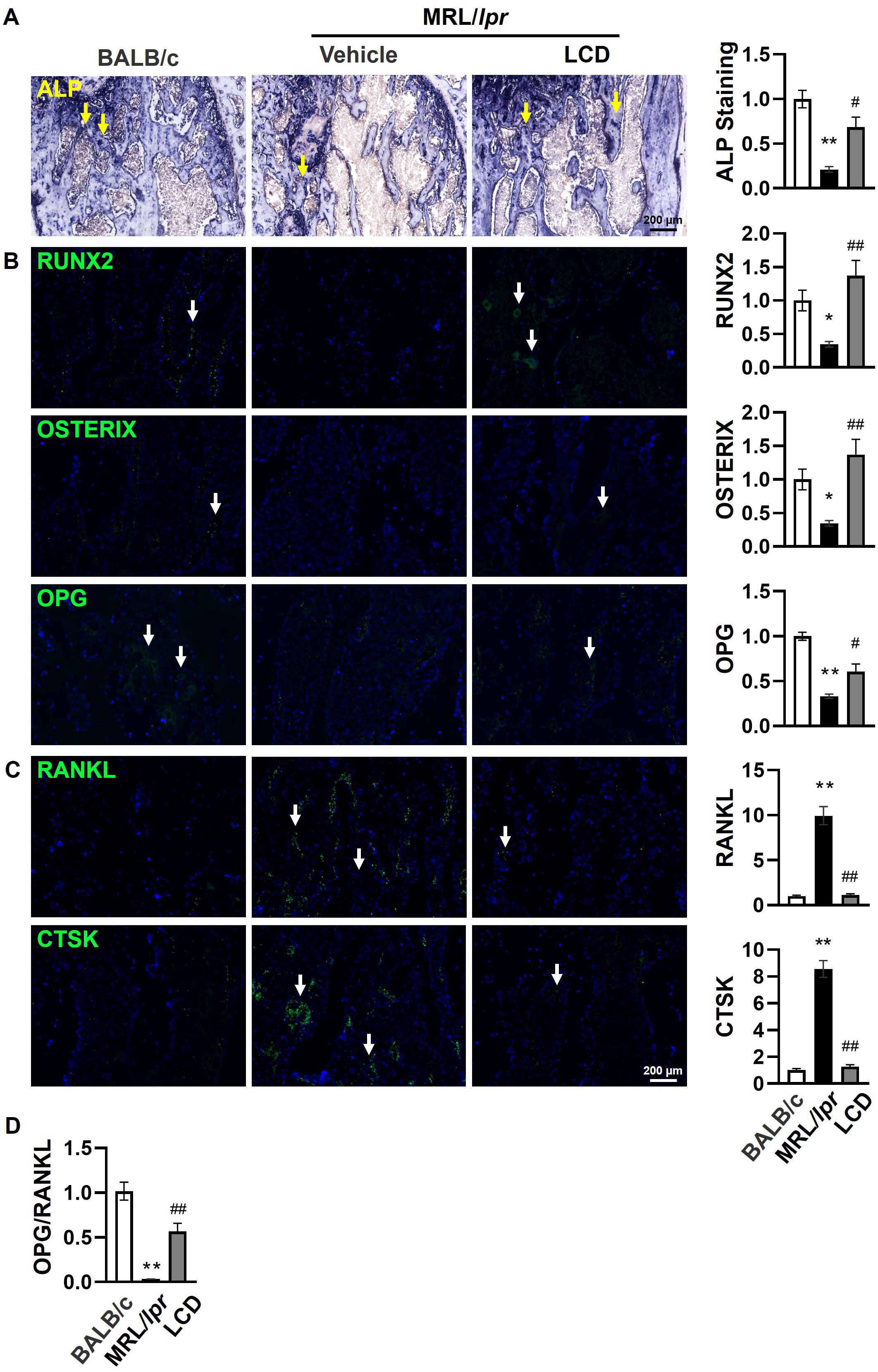 Panel A shows a bubble chart depicting pathways associated with various diseases, such as cancer and diabetes, with dot size and color indicating count and p-value. Panels B, C, and D display immunofluorescence images of protein expressions (p-i-kB, P65, p-P65) under different conditions with arrows highlighting specific areas, and adjacent bar graphs showing quantitative analysis with statistical significance noted.