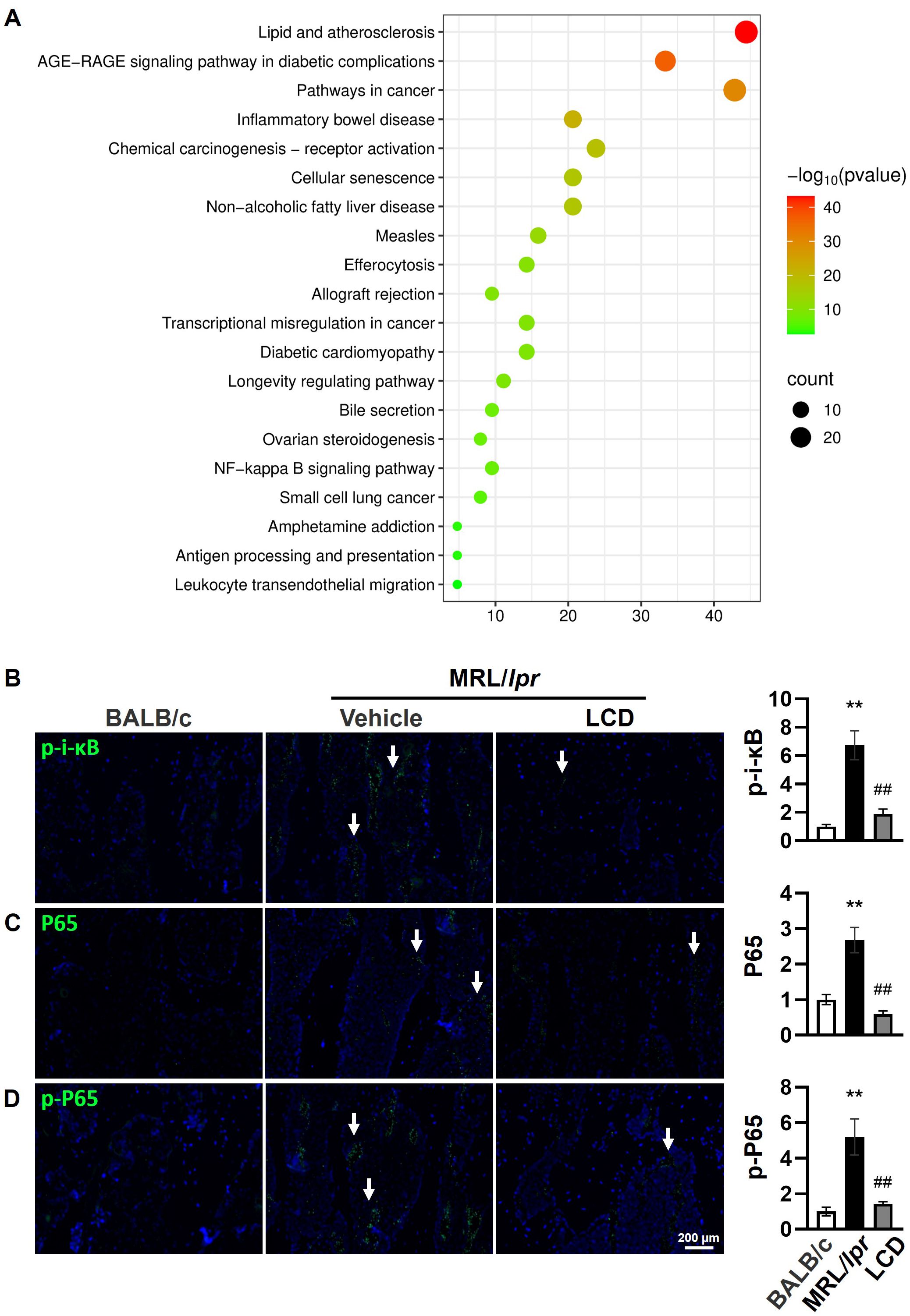 Image consists of three parts: A) A Venn diagram showing overlaps between LCD, OP, and SLE groups, with central overlap of 63 entities. B) A network diagram highlighting nodes with varying connectivity, central nodes marked in red. C) Immunofluorescence images display expression levels of IL-1β, TNF-α, and IL-6 across BALB/c, vehicle, and LCD samples. Bar graphs adjacent to images quantify cytokine levels, indicating significant differences among groups.