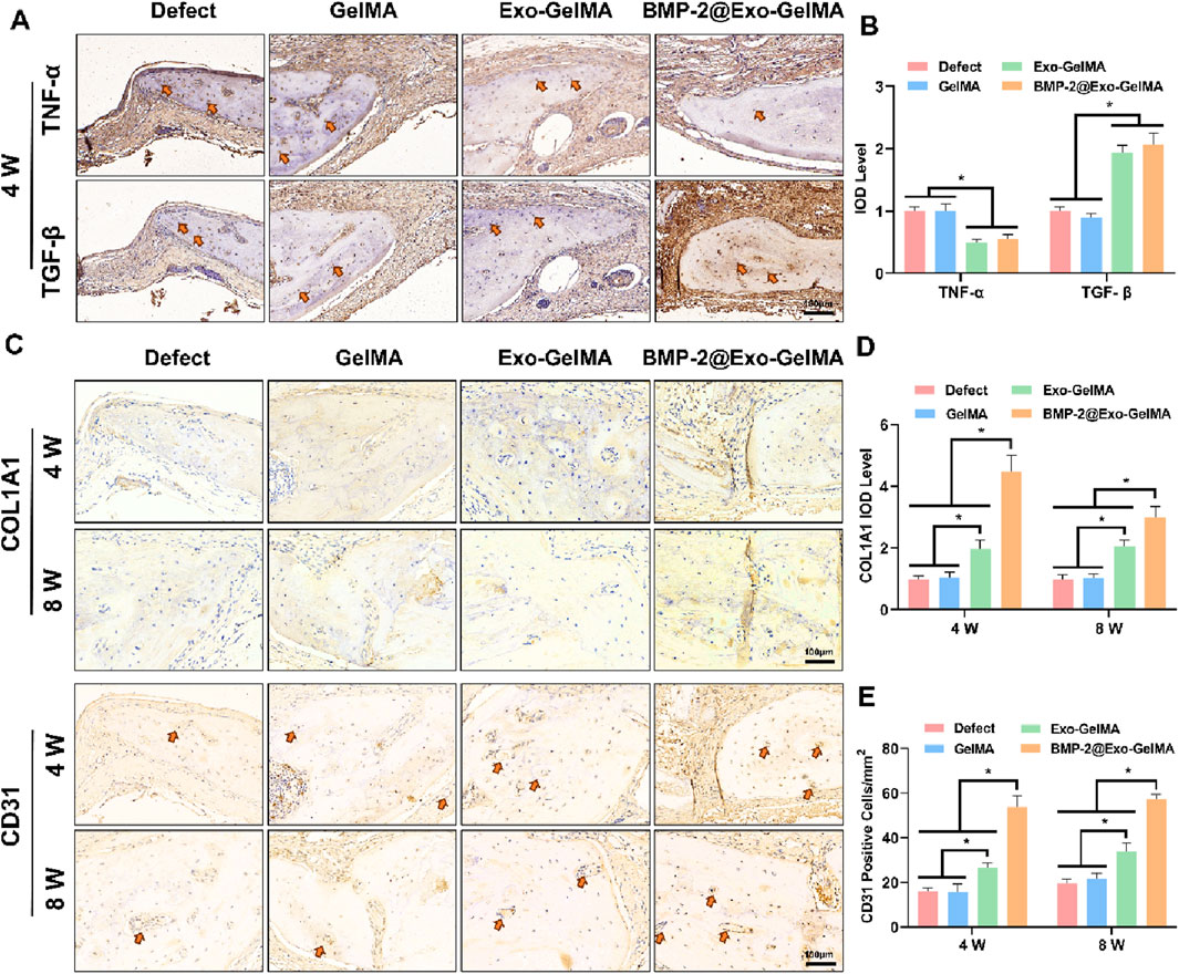Comparison of tissue samples and related data across different treatments in a medical study. Panel A shows samples with TNF-alpha and TGF-beta staining at 4 weeks, under various treatments: Defect, GelMA, Exo-GelMA, and BMP-2@Exo-GelMA. Panel B provides a bar graph of IOD levels for TNF-alpha and TGF-beta with significant differences marked. Panel C presents COL1A1 and CD31 staining at 4 and 8 weeks across the same treatments. Panel D shows a bar graph of COL1A1 IOD levels, while panel E shows CD31 positive cells per square millimeter, both indicating significant differences. Arrows point to relevant tissue areas.