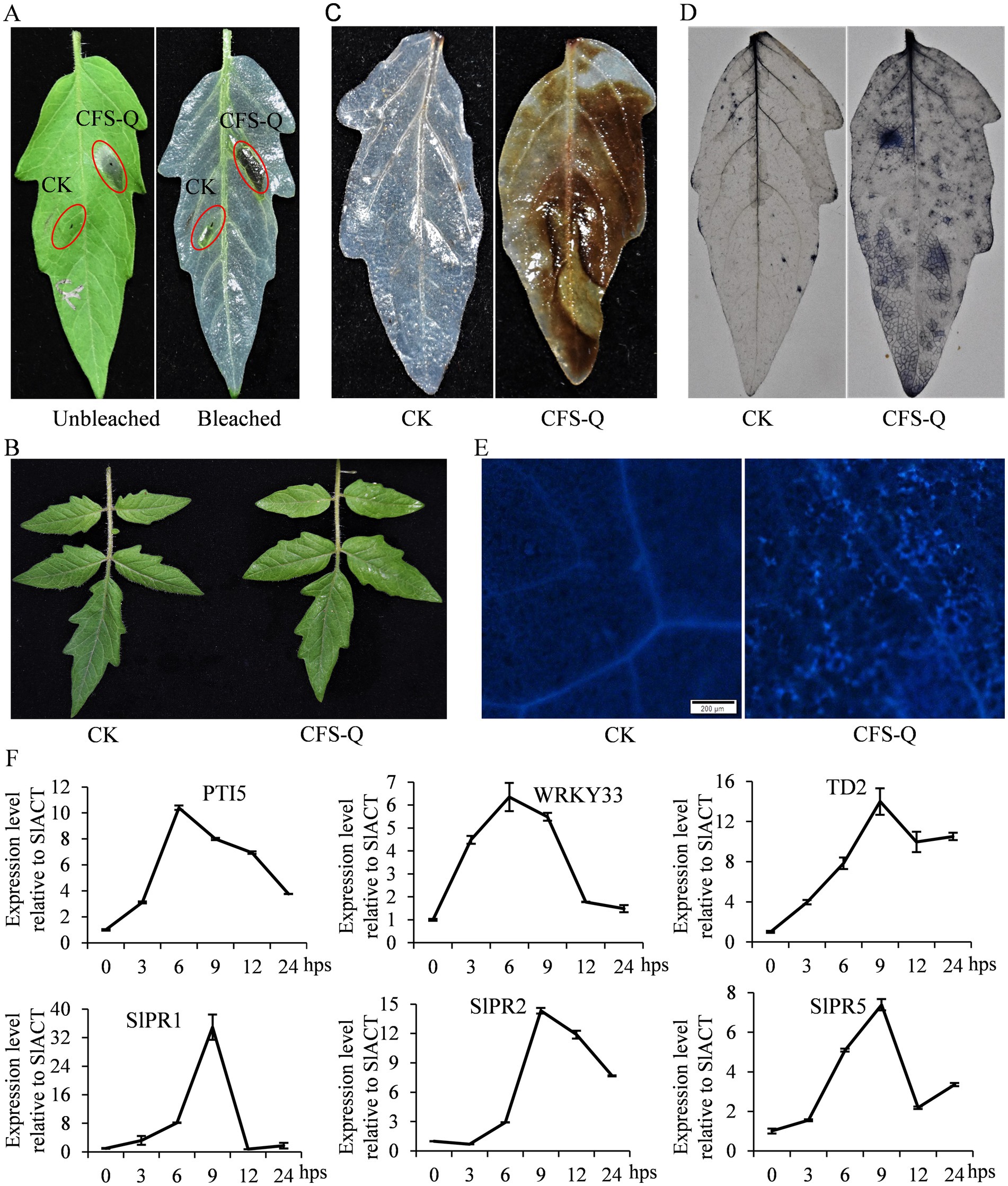 Panels show effects of treatments CK and CFS-Q on leaves. Panel A displays unbleached and bleached leaves with annotations. Panel B shows two plants under different treatments. Panel C compares two discolored leaves. Panel D highlights stained patterns on leaves. Panel E presents microscopic images of leaf structures under CK and CFS-Q. Panel F features line graphs showing expression levels of genes PTI5, WRKY33, TD2, SIPR1, SIPR2, and SIPR5 over time, with increasing trends peaking between three and twelve hours post-treatment.