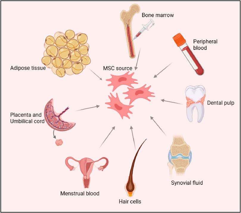 Sources of mesenchymal stem cells are illustrated, including adipose tissue, bone marrow, peripheral blood, dental pulp, synovial fluid, hair cells, menstrual blood, and placenta with umbilical cord, all converging towards a central MSC depiction.