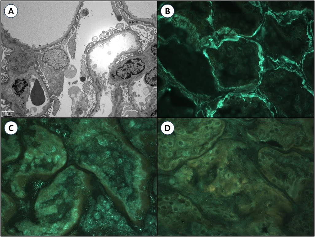 Panel A displays a grayscale microscopic image highlighting cellular structures with visible internal components. Panels B, C, and D show fluorescent microscopy images with network-like patterns. B has bright green outlines, C has a more diffuse green fluorescence, and D shows a subdued and darker green tone.