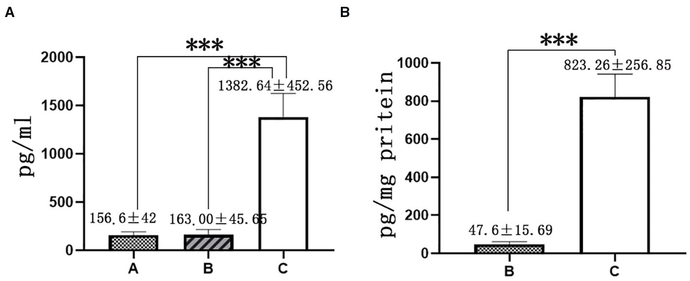 Two bar graphs comparing data sets A, B, and C. Graph A shows results in picograms per milliliter: A (156.6±42), B (163.00±45.65), and C (1382.64±452.56), with significant differences marked by asterisks. Graph B shows results in picograms per milligram protein: B (47.6±15.69) and C (823.26±256.85), also with significant differences.