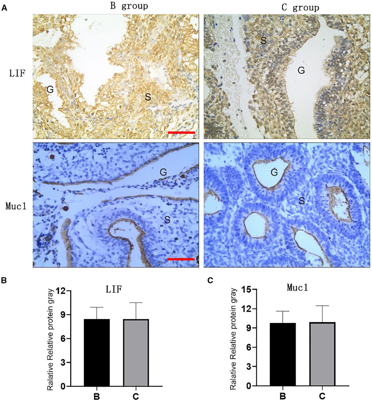 Histological analysis showing tissue samples stained for LIF and Muc1 proteins from B and C groups. The top images display LIF staining, with distinct labeling seen around glandular (G) and stromal (S) areas. The bottom images present Muc1 staining, highlighting similar regions. Two bar graphs beneath illustrate the relative protein gray values for both LIF and Muc1, comparing B and C groups, with no significant difference indicated.