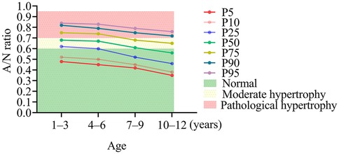 Line graph showing A/N ratio versus age in years for different percentiles (P5 to P95). Colors indicate range: green for normal, yellow for moderate hypertrophy, and pink for pathological hypertrophy. Lines generally decline with age.