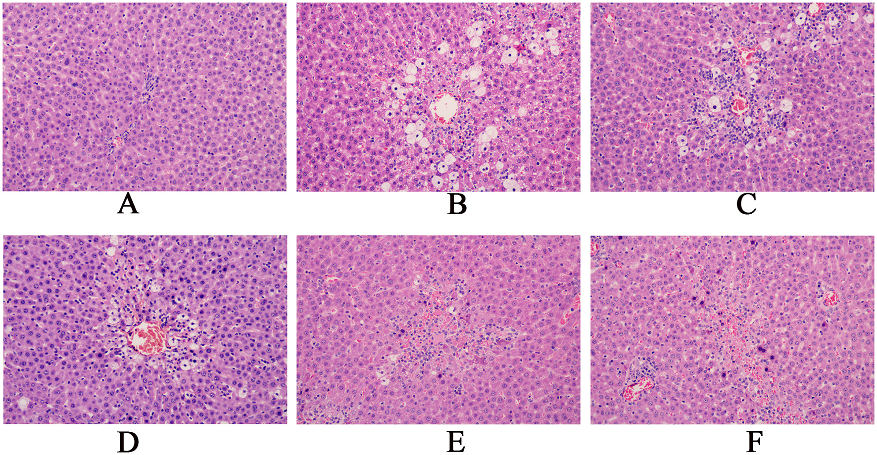 Six histological liver tissue images labeled A to F, showing different patterns of cellular arrangement and structures. Varying levels of coloration and cell density can be observed, indicating differences in tissue composition or treatment effects. Each panel displays distinct morphological characteristics under a microscope.