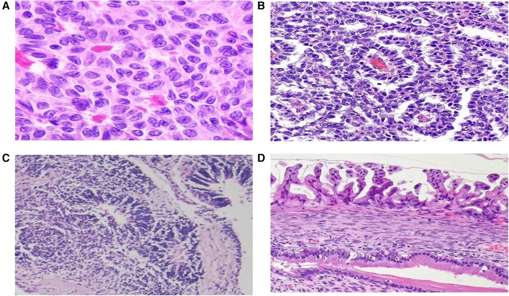 Four histological images labeled A to D. Image A shows densely packed cells with large, dark nuclei. Image B depicts a similar pattern with more fibrous tissue visible. Image C shows darker, more densely clustered cells with a central lumen. Image D displays elongated cell structures aligned parallel to each other in a layered pattern.