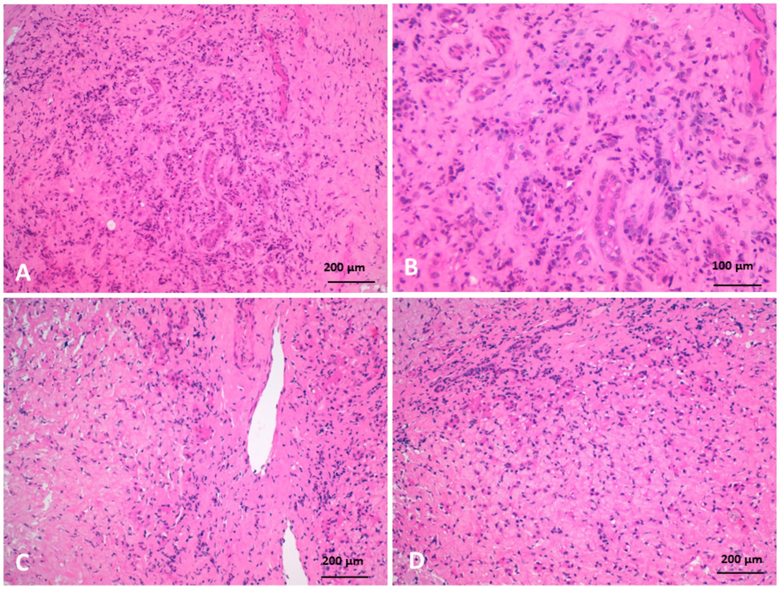 Histological images show four panels labeled A to D, displaying tissue samples stained in pink and purple hues. Panel A and B reveal dense cellular structures with visible nuclei. Panels C and D exhibit more dispersed cellular formations and fibrous tissue. Scale bars indicate sizes from one hundred to two hundred micrometers.