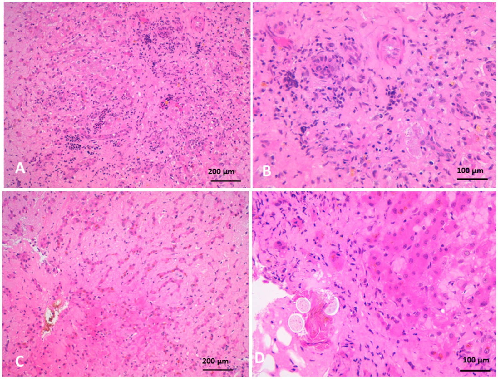Microscopic images of tissue sections labeled A through D, showing cellular structures with varying densities. Panels A and C depict larger, less dense cellular arrangements with 200 micrometer scale bars. Panels B and D display more densely packed cells with 100 micrometer scale bars, highlighting differences in tissue morphology. The pink and purple staining indicates the presence of nuclei and cytoplasm.