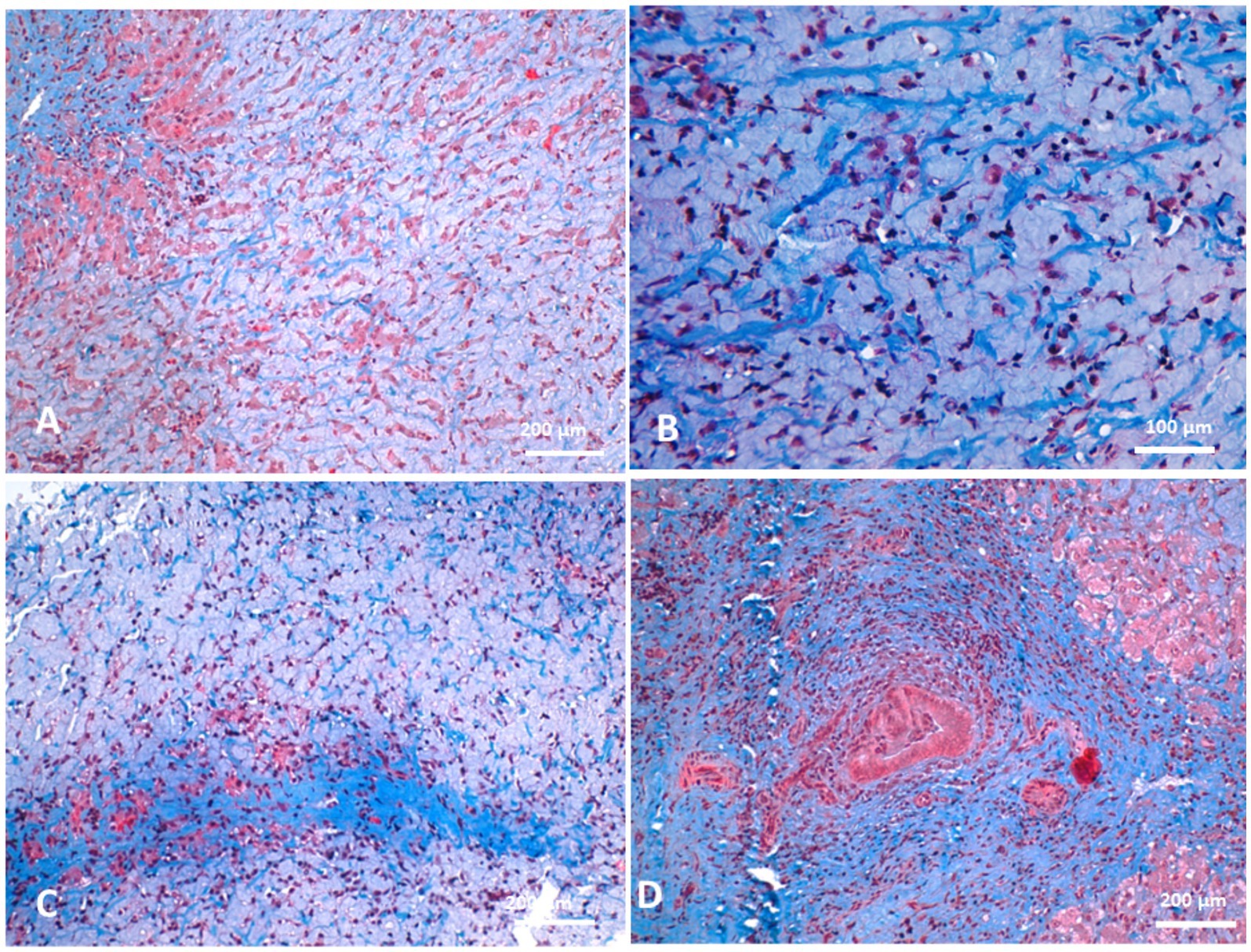 Histological images of tissue sections stained in pink, blue, and purple hues. Panel A shows a widespread distribution of cells and fibers. Panel B presents a denser cellular arrangement. Panel C highlights a blue-stained area indicating a distinct feature. Panel D displays a circular pattern suggesting a vascular structure. Each section is marked with a scale bar for reference.