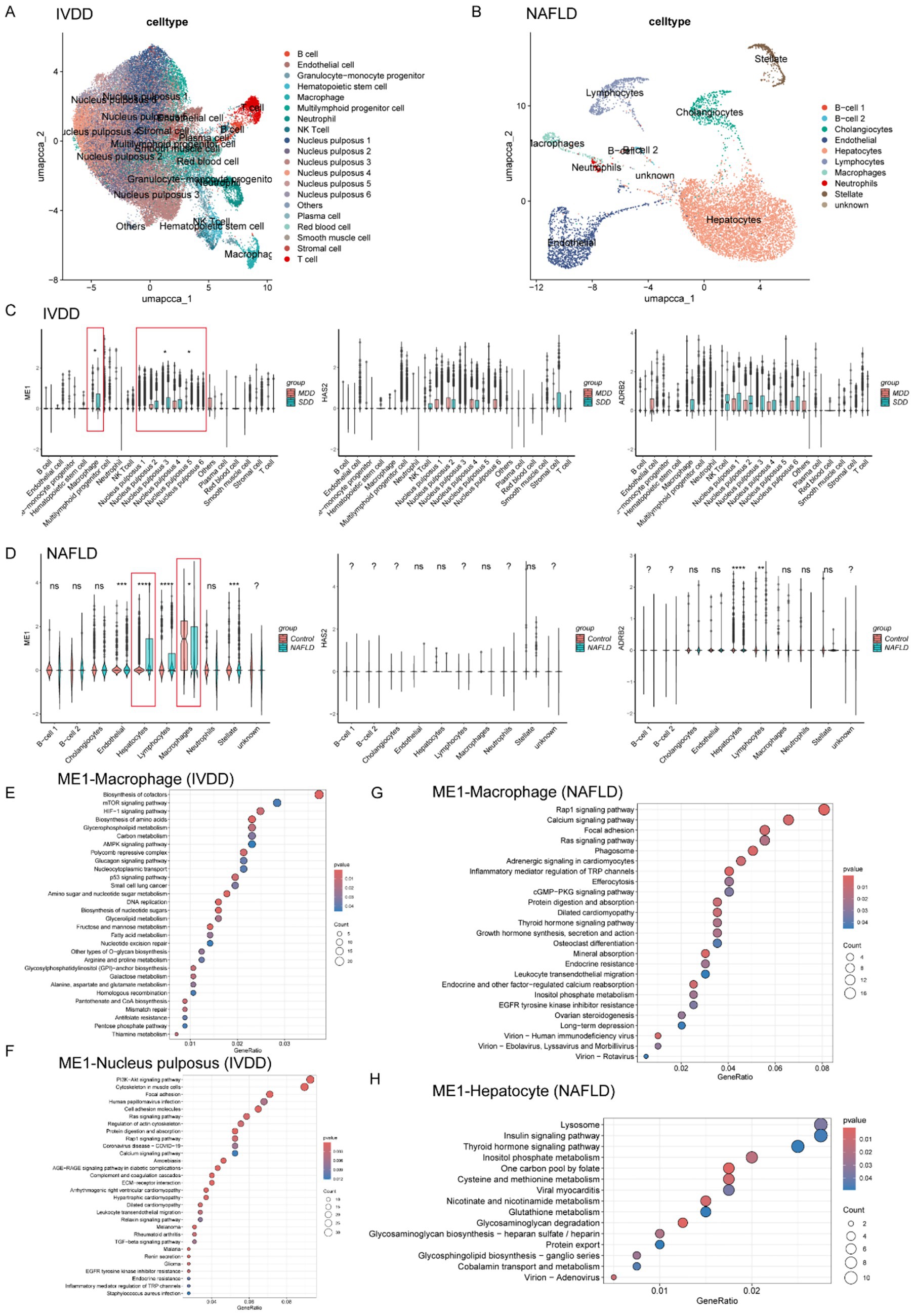 Visualizations of single-cell RNA sequencing data and pathway analysis related to intervertebral disc degeneration (IVDD) and non-alcoholic fatty liver disease (NAFLD). Panels A and B show cell type clustering, C and D depict violin plots of gene expression for different groups, and E to H highlight pathways via bubble charts for macrophages and other cell types in IVDD and NAFLD. Cell types and pathways are annotated with statistical significance and gene ratios.