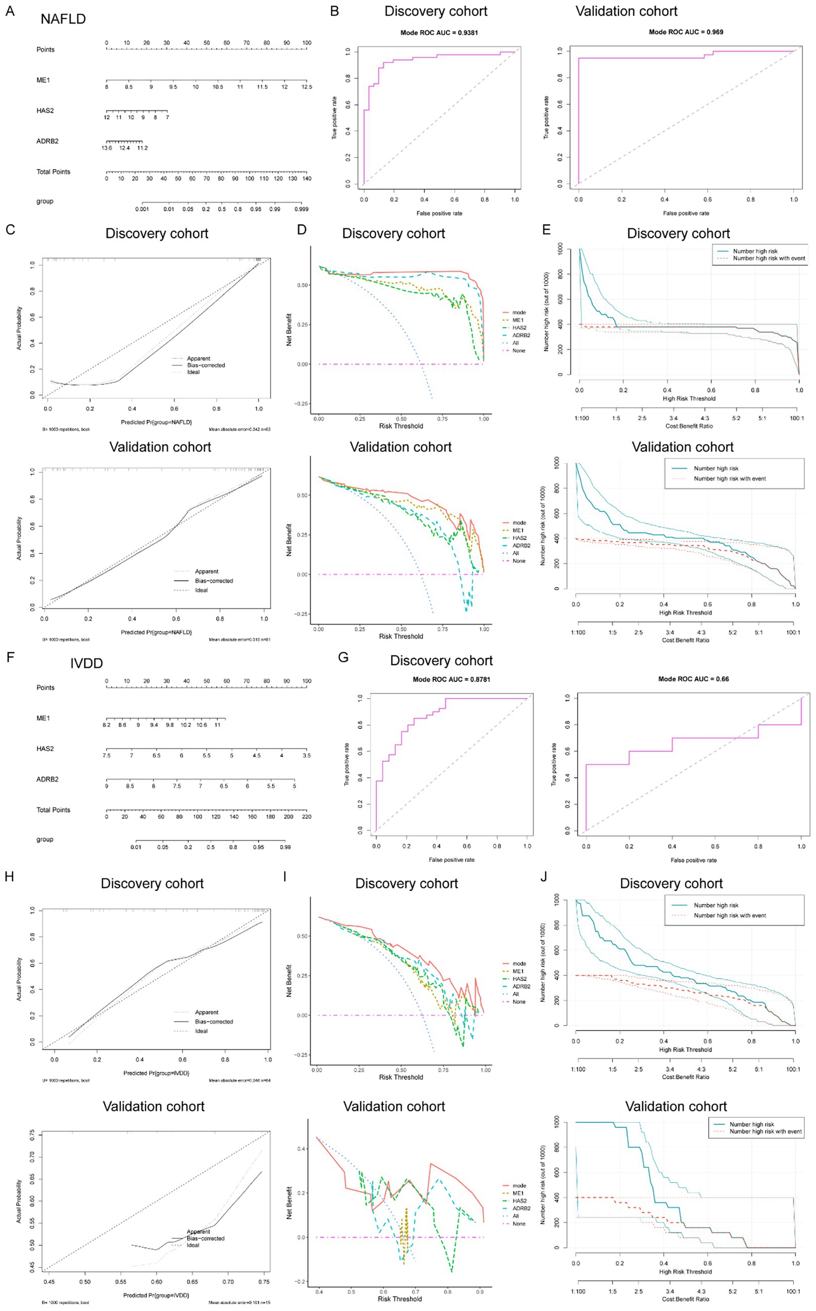 The image contains a series of graphs and charts related to NAFLD (Non-Alcoholic Fatty Liver Disease) and IVDD (Intervertebral Disc Degeneration) analysis. Panels A and F display point systems for predicting risk based on factors like ME1, HAS2, and ADRB2. Panels B and G show ROC curves for discovery and validation cohorts with AUC values. Panels C and H include calibration curves displaying observed versus predicted probabilities. Panels D, E, I, and J present decision curve analyses indicating net benefits and cost-benefit ratios for different models across discovery and validation cohorts.