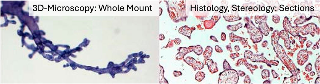 Comparison of microscopy techniques: Left side shows a 3D-microscopy whole mount with a branching blue structure on a light background. Right side shows histology sections with red-stained circular structures on a light background, labeled