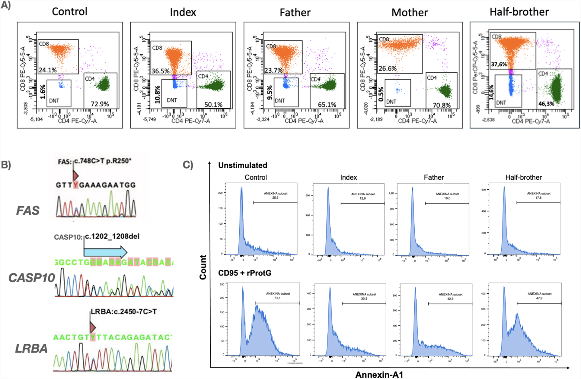 (A) Flow cytometry plots for control, index, father, mother, and half-brother showing CD8, CD4, and DNT cell populations with percentages. (B) Genetic sequences highlight mutations in FAS (c.748C > T), CASP10 (c.1202_1208del), and LRBA (c.2450-7C>T). (C) Histograms representing apoptosis assay results using Annexin V staining in unstimulated and CD95 plus rProtG-stimulated conditions in control, index, father, and half-brother samples, showing apoptotic profiles.