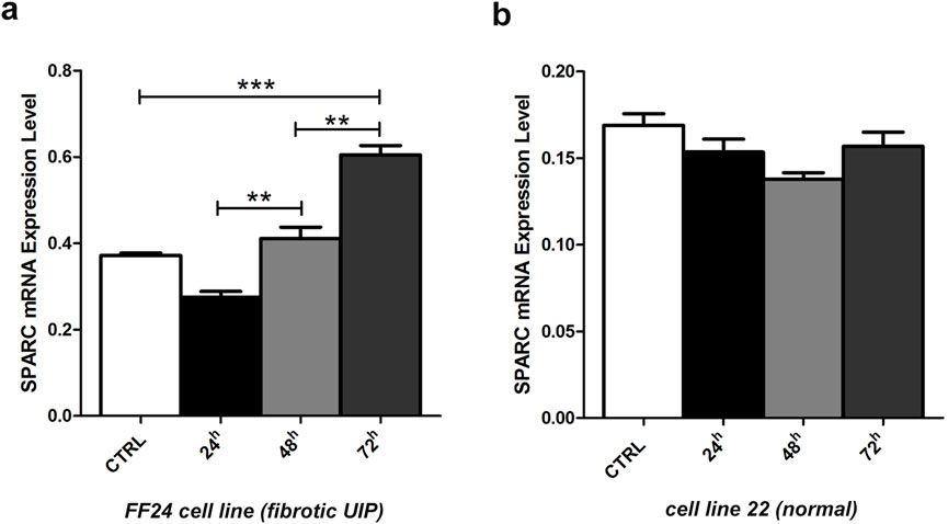 Bar graph showing SPARC mRNA expression levels in two cell lines. Panel (a) depicts increasing expression levels over 72 hours in FF24 cell line (fibrotic UIP) with significant differences marked by asterisks. Panel (b) shows relatively steady expression levels in cell line 22 (normal) over the same period.