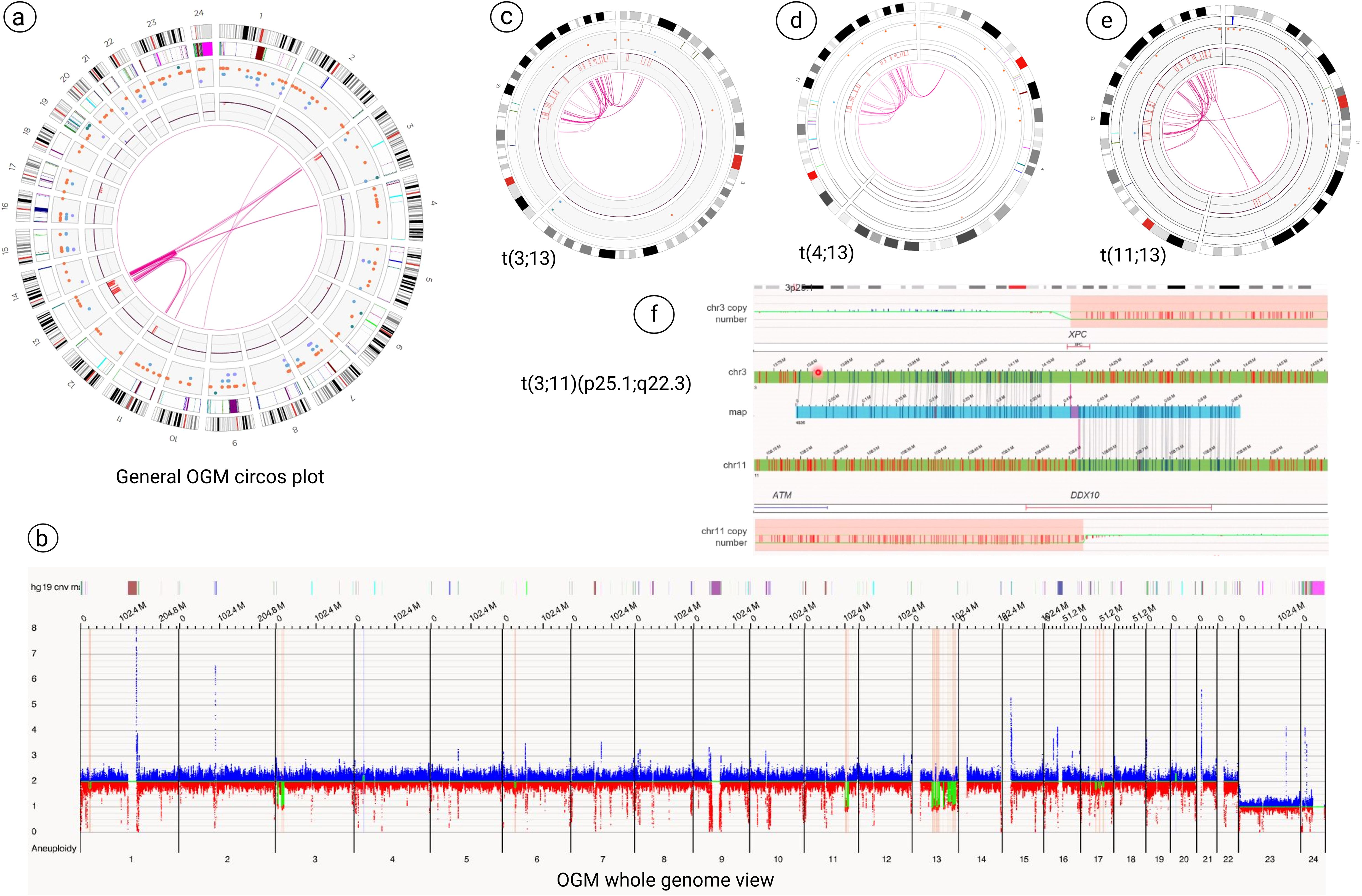 A set of diagrams showing genomic data visualizations. Image (a) displays a circos plot with colored connections and annotations for genome mapping. Images (c), (d), and (e) depict detailed circos plots highlighting specific translocations: t(3;13), t(4;13), and t(11;13), respectively. Image (b) presents a whole genome view chart with blue and red lines indicating copy number variations and aneuploidy along numbered chromosomes. Image (f) shows a detailed chromosome map focusing on translocation t(3;11)(p25.1;q22.3), with chromosome landmarks and gene annotations.