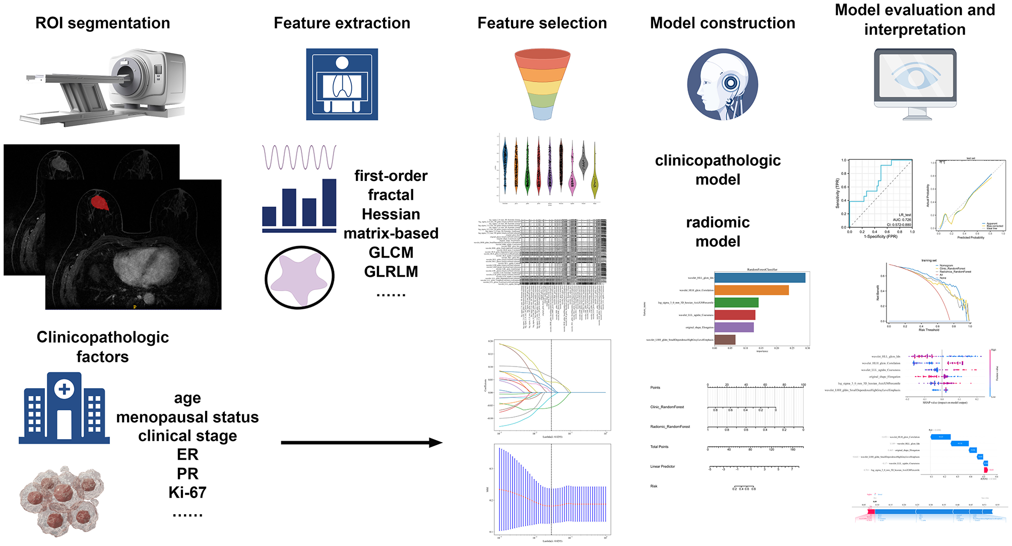 Flowchart illustrating the process of developing a radiomics model. It starts with ROI segmentation showing a scanner and breast images, followed by feature extraction using various methods. Feature selection is depicted with diagrams and lists. Model construction involves clinicopathologic and radiomic models, visualized with graphs and charts. Finally, model evaluation and interpretation are illustrated with additional graphs on a computer screen. Key clinicopathologic factors like age and menopausal status are noted.